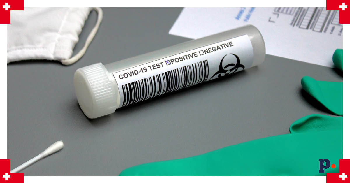 test na koronawirusa