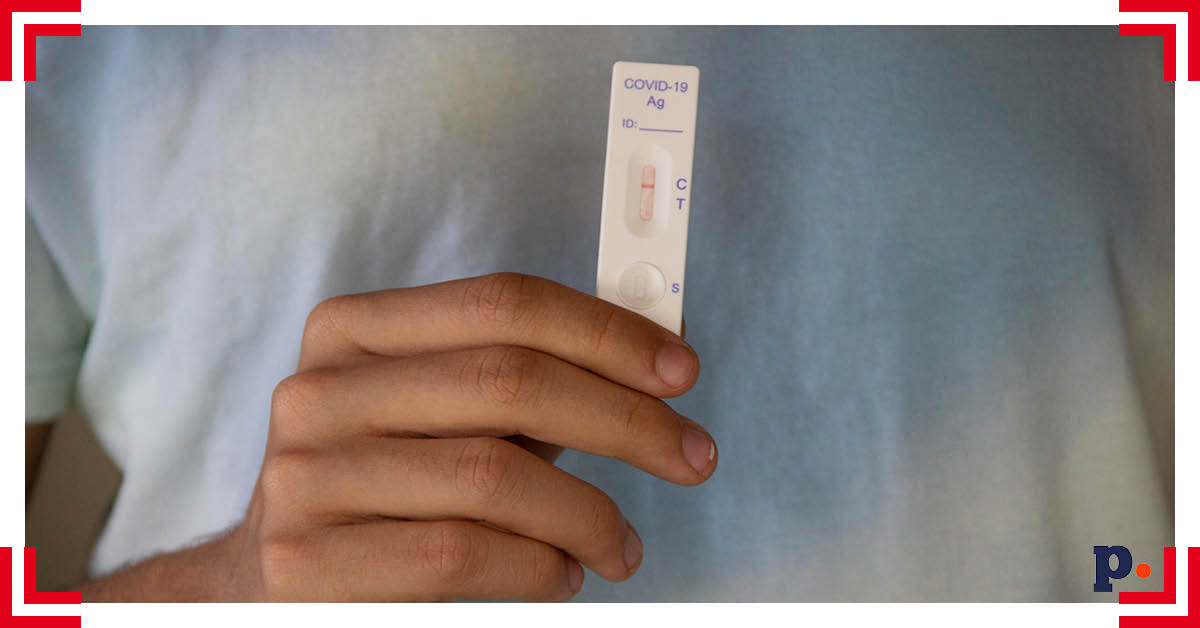 test na koronawirusa